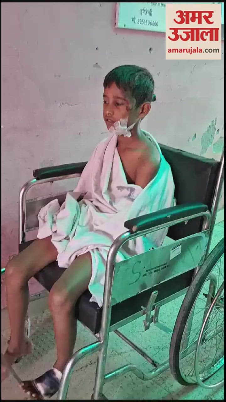 VIDEO : रूह कंपाने वाला एक्सीडेंट, हादसे में बचे बच्चे ने बताया कैसा था मंजर, देखें वीडियो