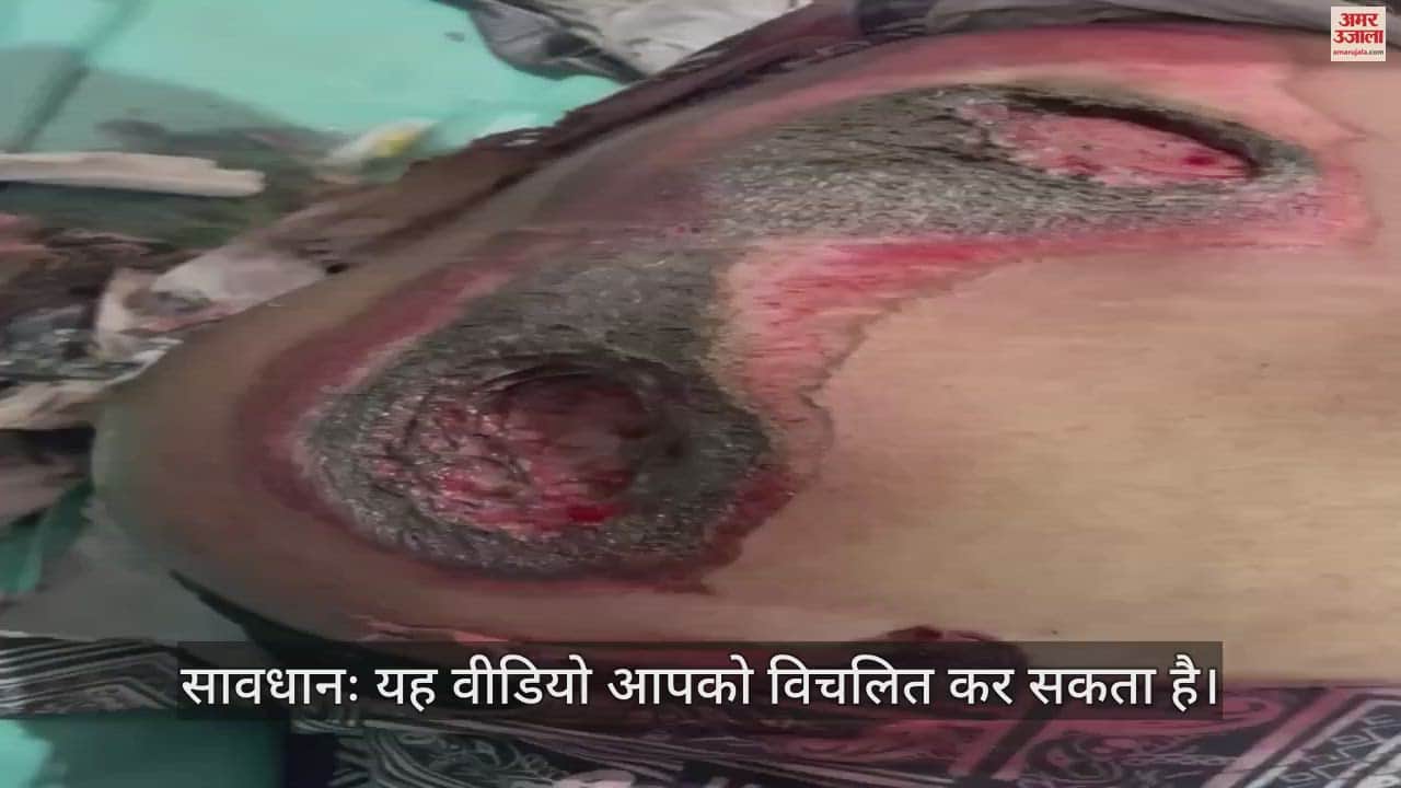VIDEO : पांच रुपये कम किराया देने पर ऑटो चालक ने मारी छात्र को टक्कर, 300 मीटर तक घसीटा