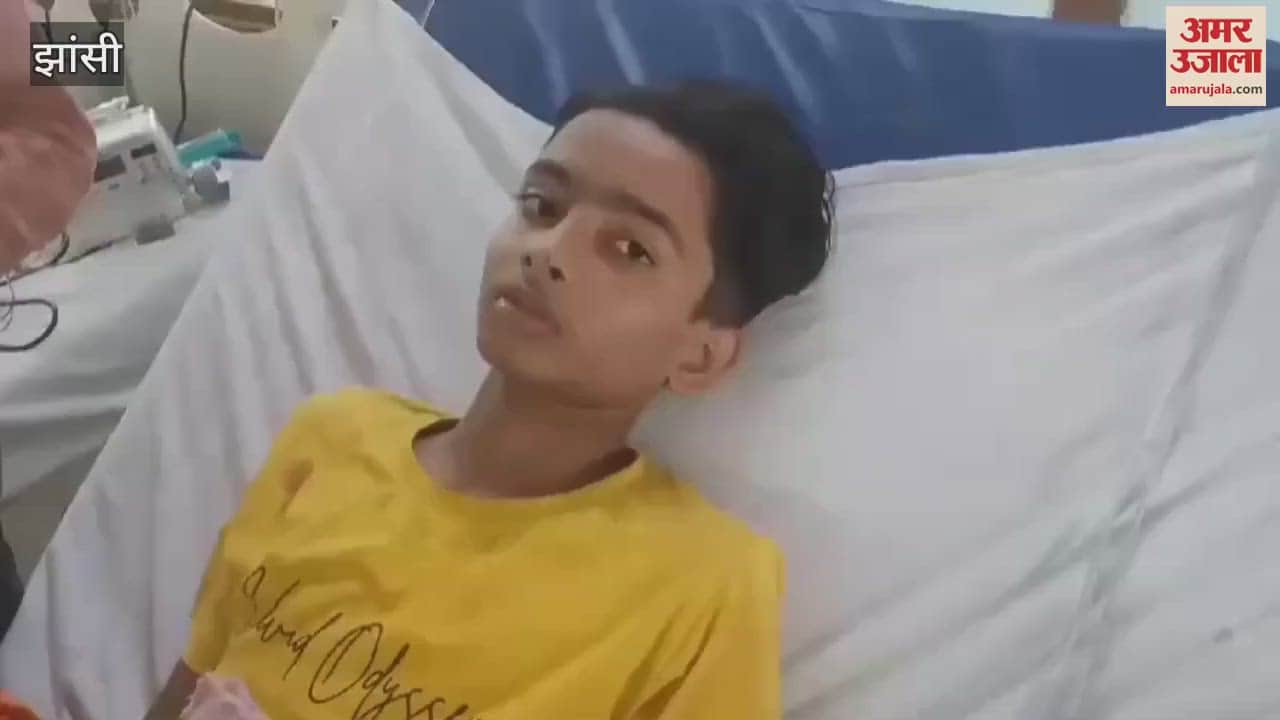 VIDEO : sanke bite son family caught the snake and brought him to the hospital doctors saved his life in jhansi