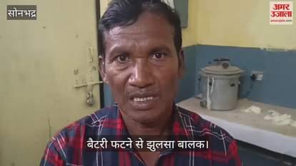 VIDEO : child burnt when battery exploded with loud bang while charging in sonbhadra