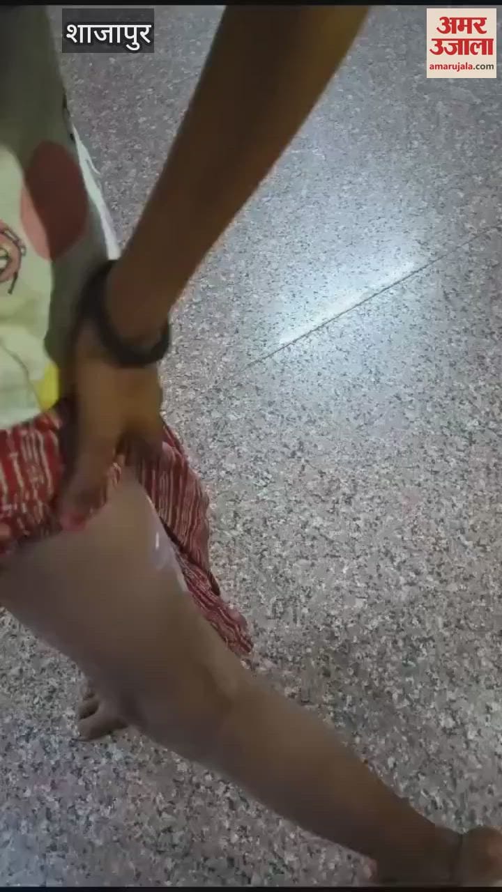 Shajapur mein 10 varshiy bacchi ko kutton Ne banaya shikar Kiya Ghayal
