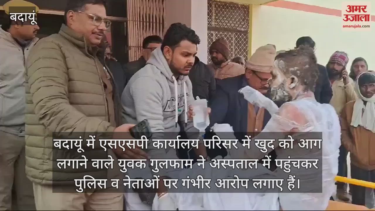 VIDEO : सीओ सिटी, कोतवाल और विधायक ने किया मजबूर, खुद को आग लगाने वाले युवक का आरोप