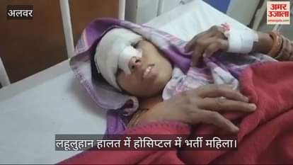 Woman beaten badly by her own husband