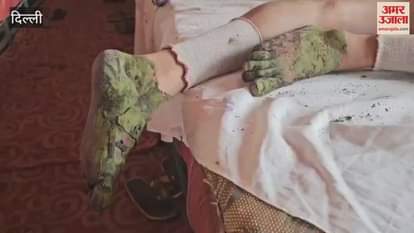 Kanwariyas reduce burning sensation by applying henna and indigo