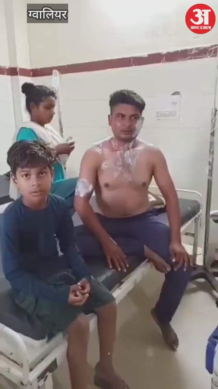 Gwalior News: Terrifying wife pours boiling water on sleeping husband, injured man rushed to hospital