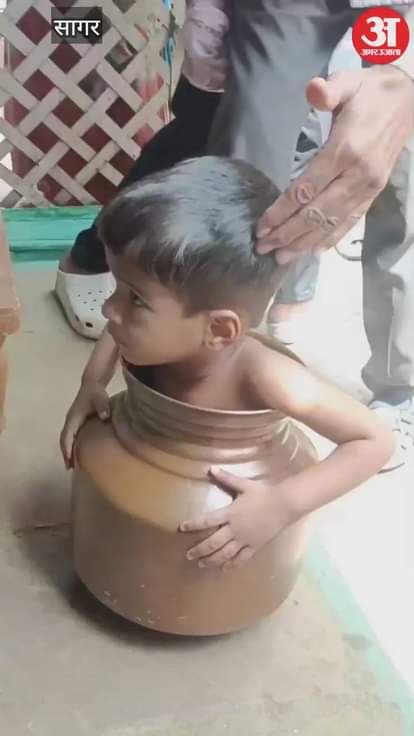 Sagar News: Two-year-old child stuck in a water pot while playing