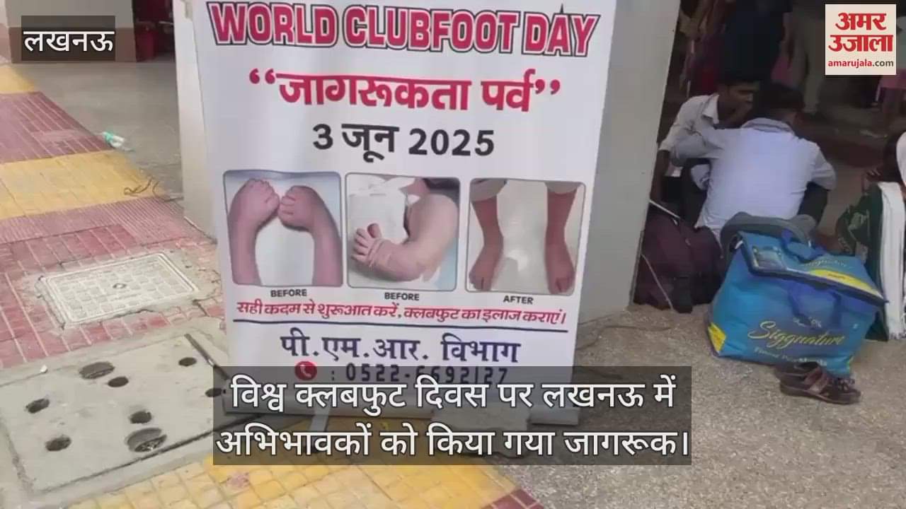 विश्व क्लबफुट दिवस पर लखनऊ में अभिभावकों को किया गया जागरूक