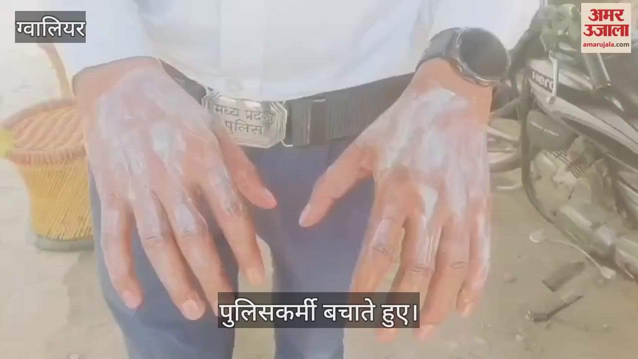 Husband tried to burn his wife, traffic police burnt his hands while saving her