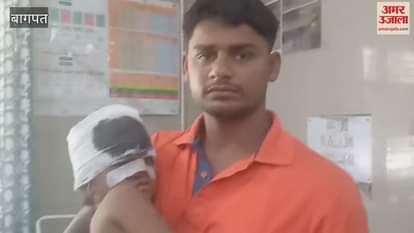 Dogs bite many including kids an women, refer to Delhi