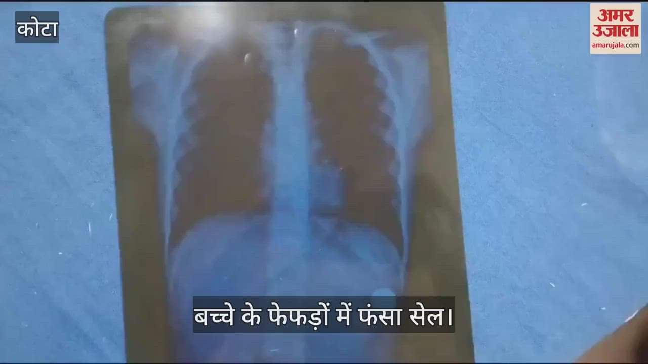 Kota News: The child swallowed a cell while playing, got stuck in lungs, was trying to find a way to remove