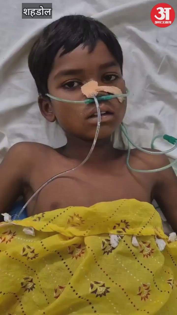 Doctors brought child back from clutches of death, family had brought him to hospital after snake bite