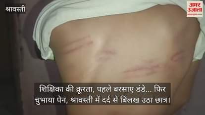 शिक्षिका की क्रूरता, पहले बरसाए डंडे... फिर चुभाया पेन, श्रावस्ती में दर्द से बिलख उठा छात्र