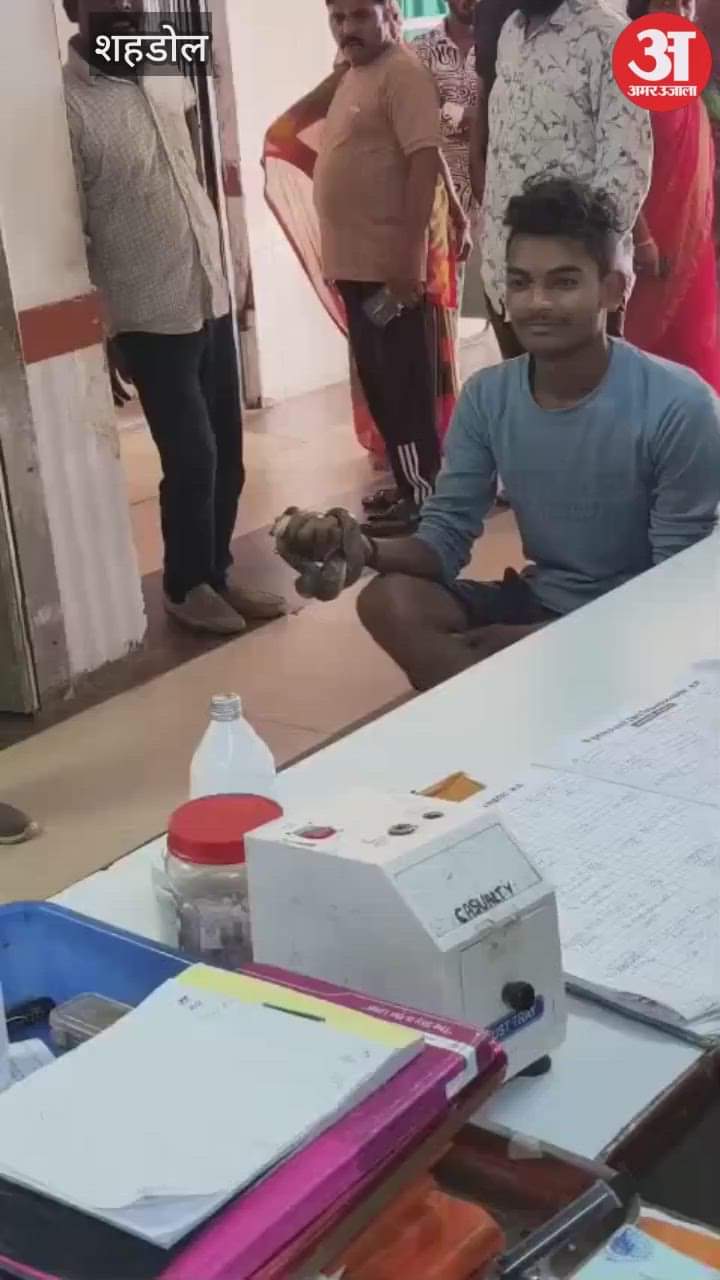 Shahdol News: The young man caught the snake that bit him and reached the hospital