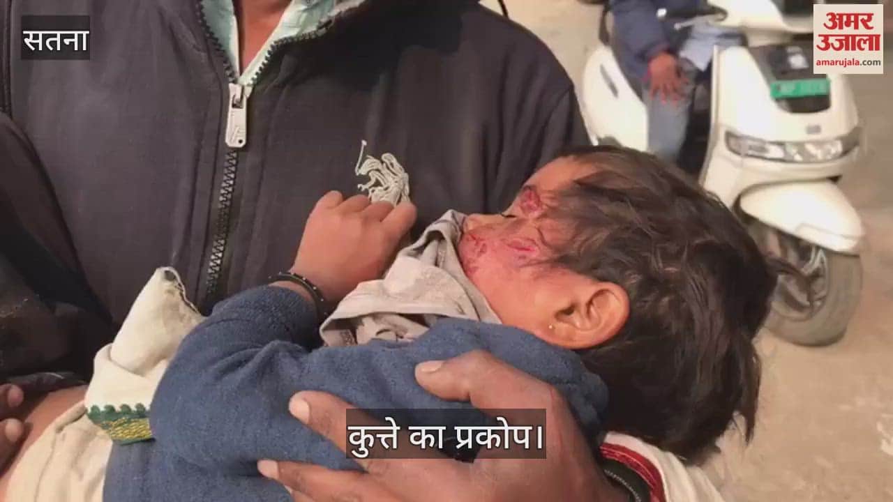 A 5-year-old innocent was attacked by a rabid dog in Satna, his face was badly injured