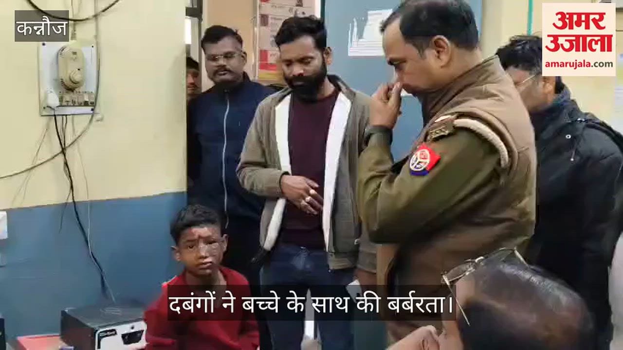 कन्नौज: कबाड़ उठाने पर मासूम पर फेंका तेजाब, फिर कूड़े में रगड़ दिया चेहरा; इलाके में भारी तनाव