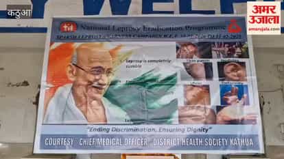 15-day leprosy eradication campaign begins in Kathua on Mahatma Gandhi's death anniversary
