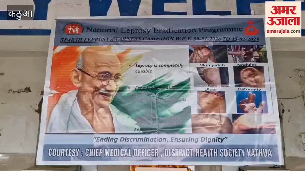 15-day leprosy eradication campaign begins in Kathua on Mahatma Gandhi's death anniversary