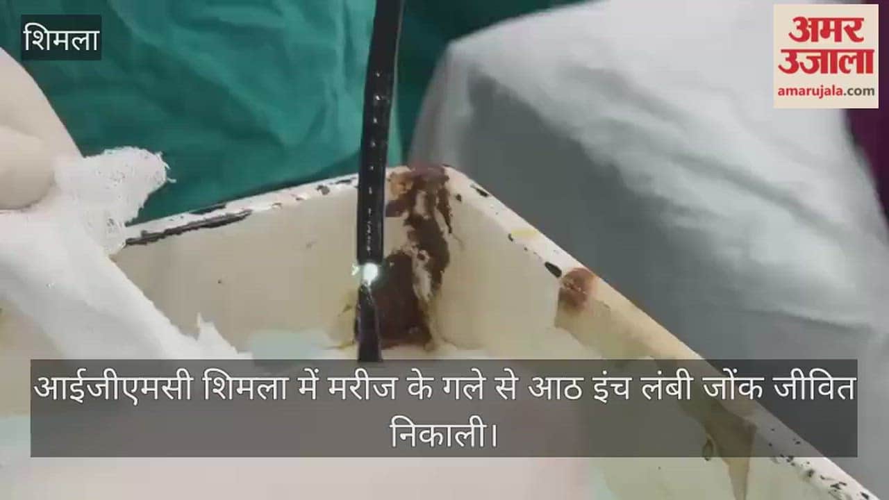 A live, eight-inch-long leech was removed from a patient's throat at IGMC Shimla.