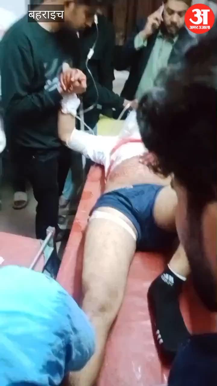 बहराइच में एसबीआई बीसी संचालक को गोली मारी, लखनऊ रेफर