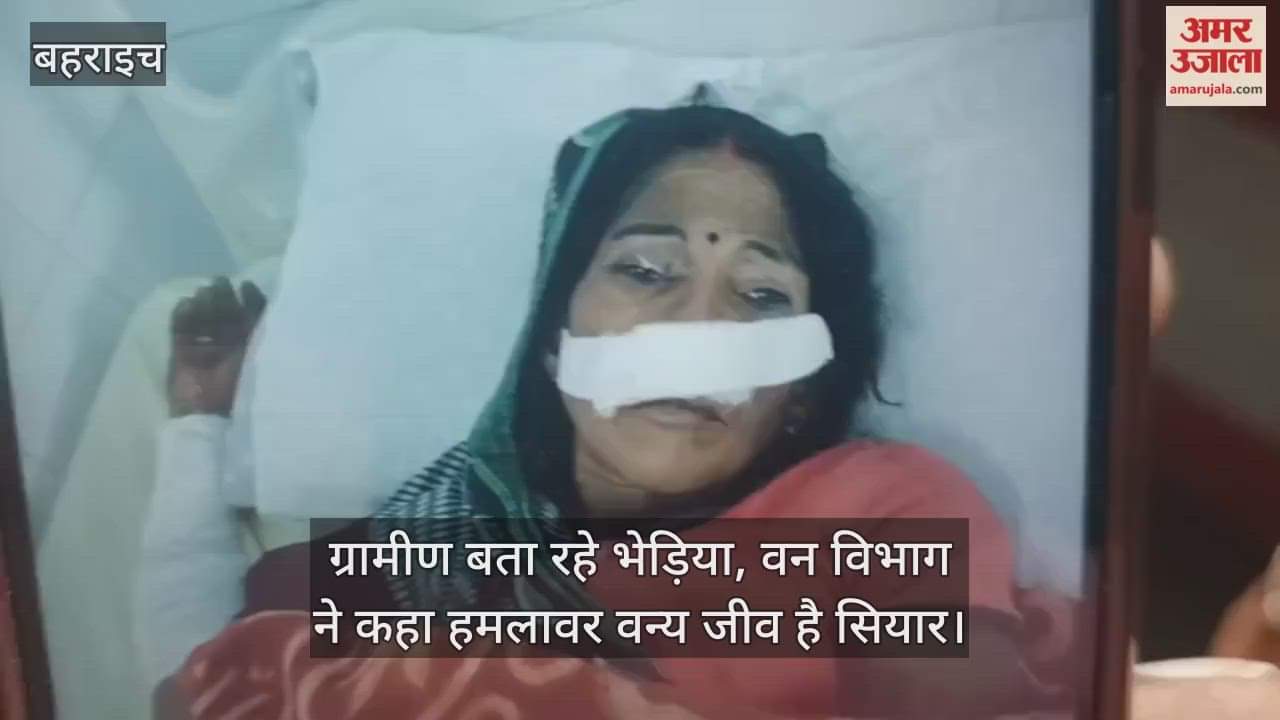 VIDEO: सियार के हमले में महिला समेत चार घायल, वन विभाग कॉबिंग में जुटा