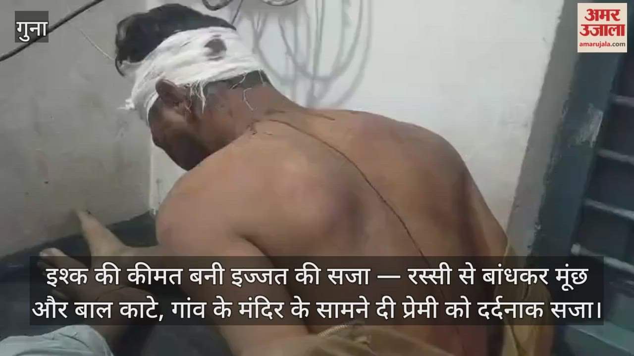 young man who had come to meet his girlfriend was beaten and then half his head and moustache were chopped off