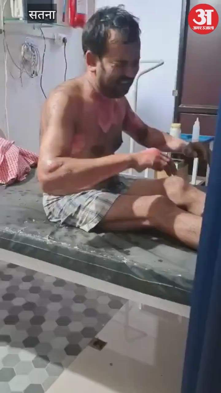 Habitual criminals set fire to a grocery store in Kothi by pouring petrol, the shopkeeper was seriously burnt