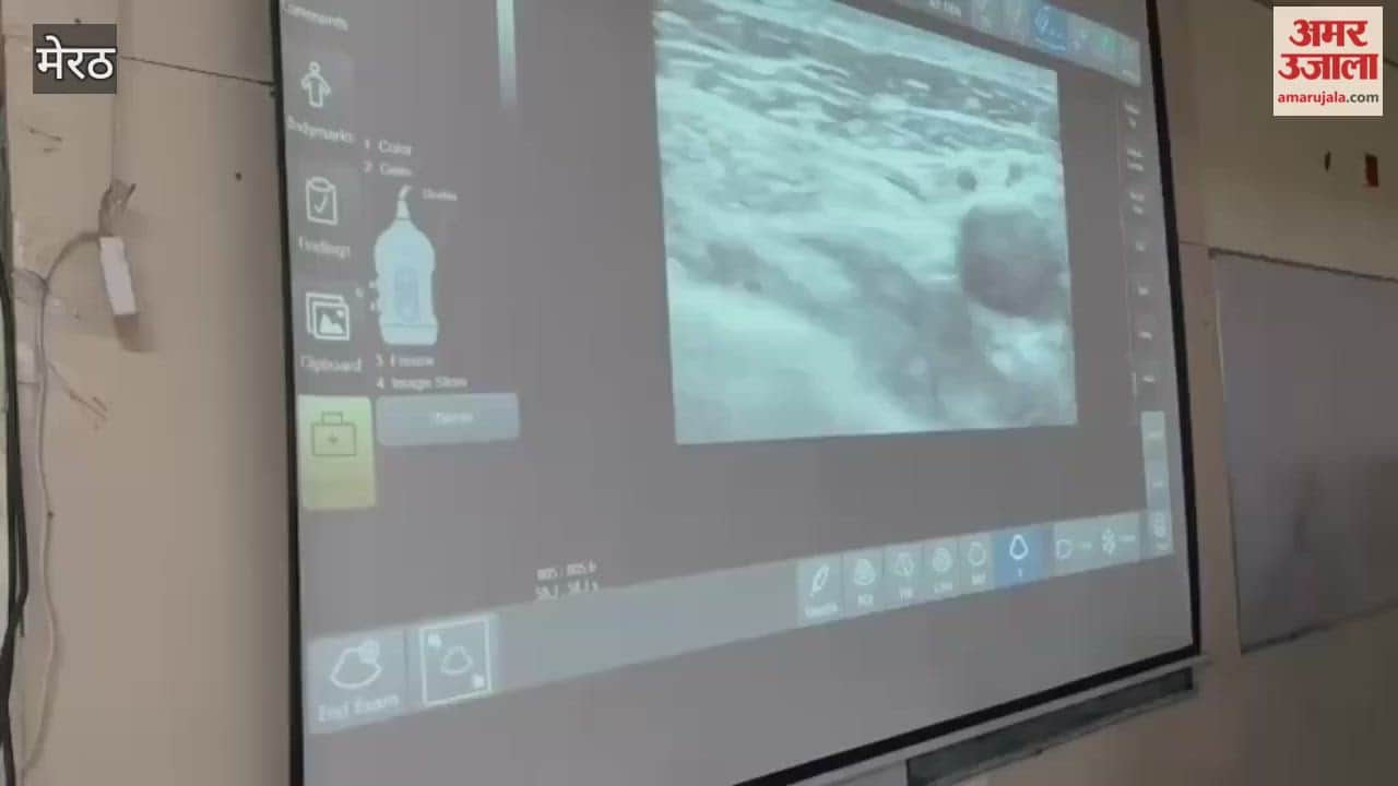 Meerut: Ultrasound demonstration on the second day of Regional Anesthesia Conference