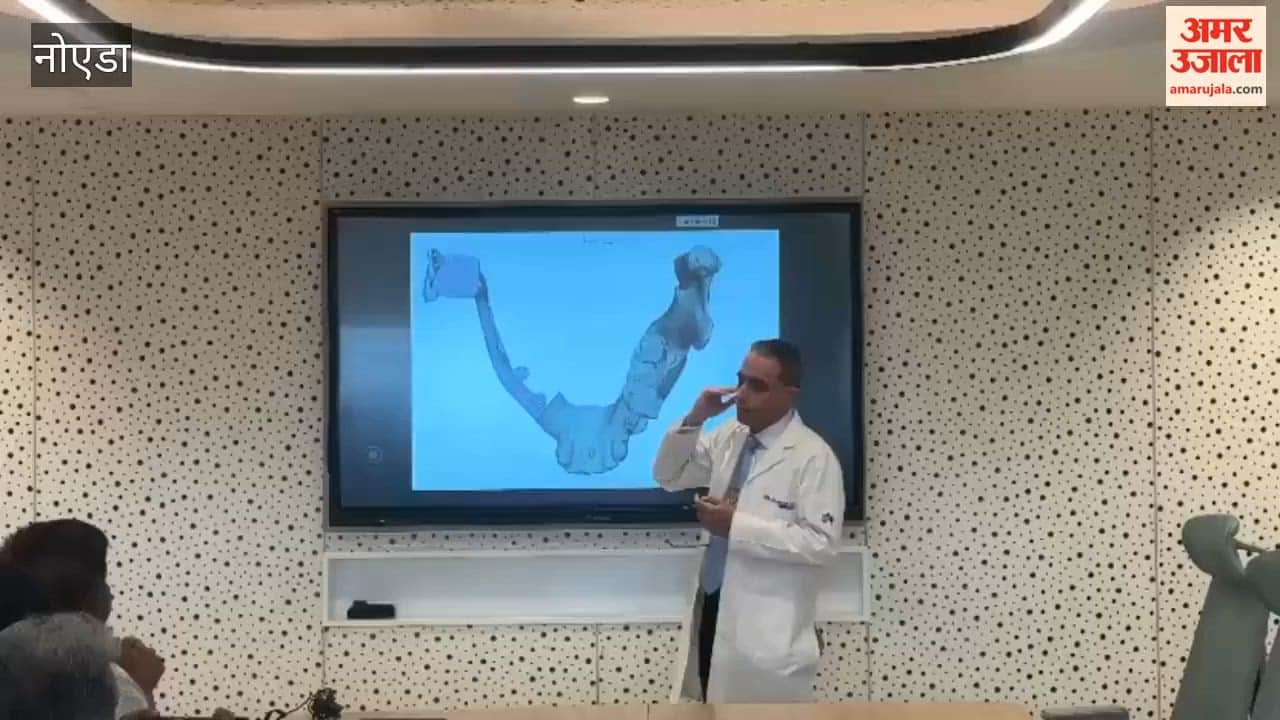 Doctors provided detailed information regarding the success of a complex jaw surgery during a press conference