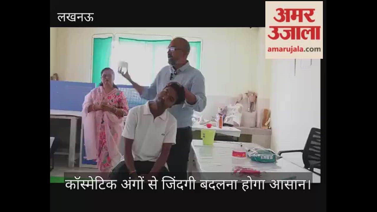 लखनऊ: कॉस्मेटिक अंगों से जिंदगी बदलना होगा आसान, पुनर्वास विवि में कृत्रिम अंग बनाने का प्रशिक्षण शुरू