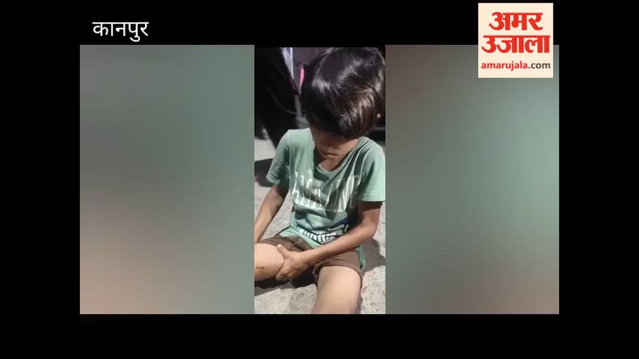 Kanpur: Child bitten by dog while playing outside home in Chakeri