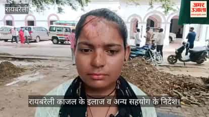 रायबरेली: डलमऊ के काजल पर तेजाब फेंककर जलाने का प्रयास