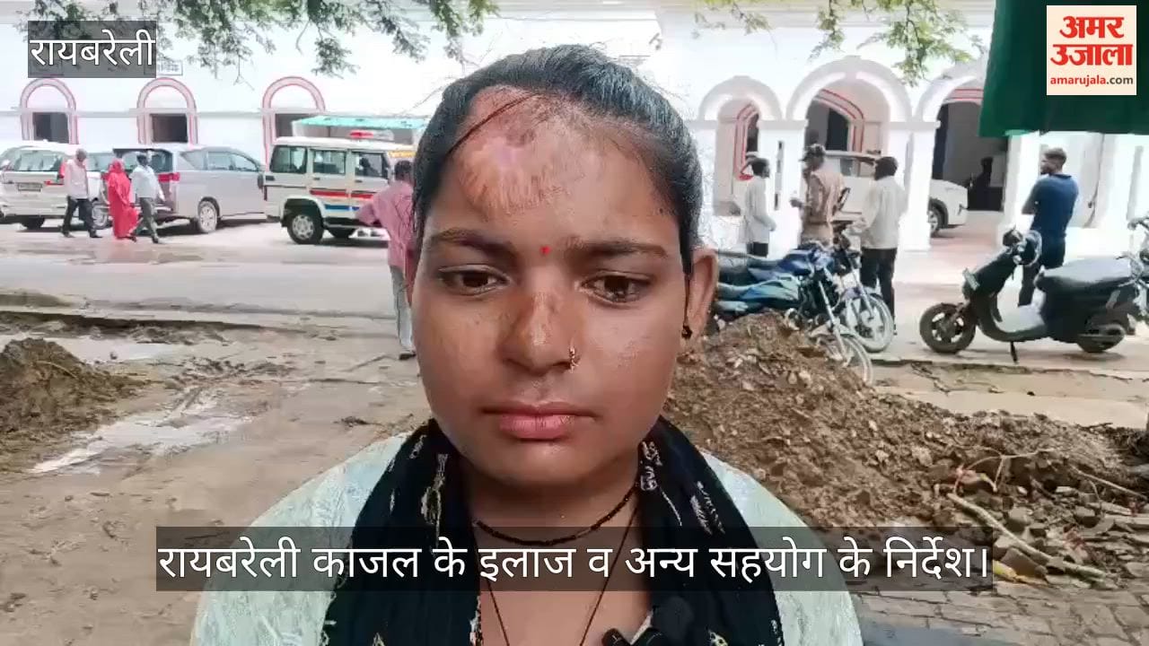 रायबरेली: डलमऊ के काजल पर तेजाब फेंककर जलाने का प्रयास