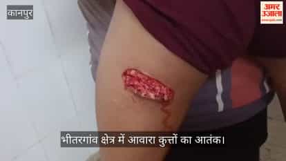 bhitargaon-stray-dog-attack-12-people-bitten-child-seriously-injured-kanpur