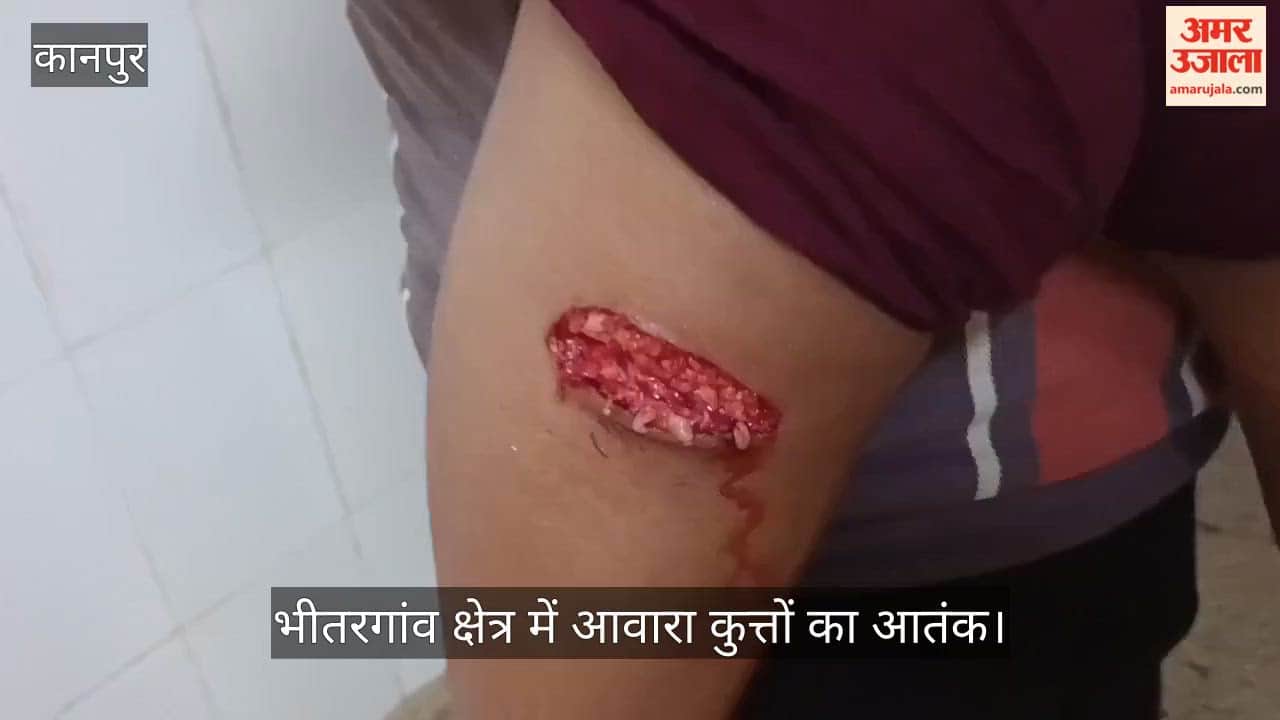 bhitargaon-stray-dog-attack-12-people-bitten-child-seriously-injured-kanpur