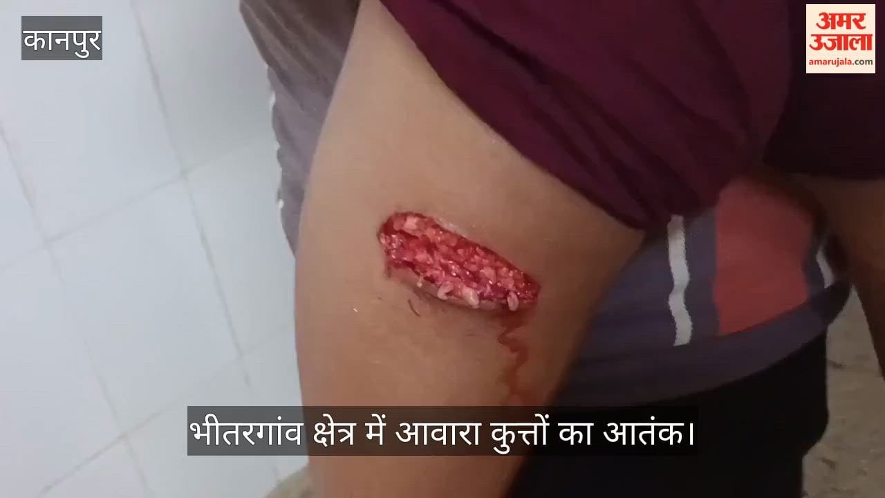 bhitargaon-stray-dog-attack-12-people-bitten-child-seriously-injured-kanpur