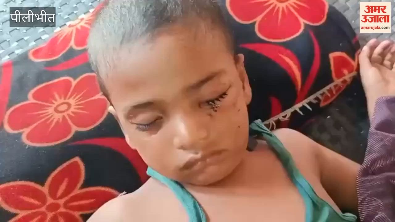 Jackal attacks three villagers, including an innocent child