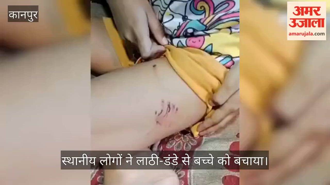 Kanpur German Shepherd attacks fifth grade student returning from coaching