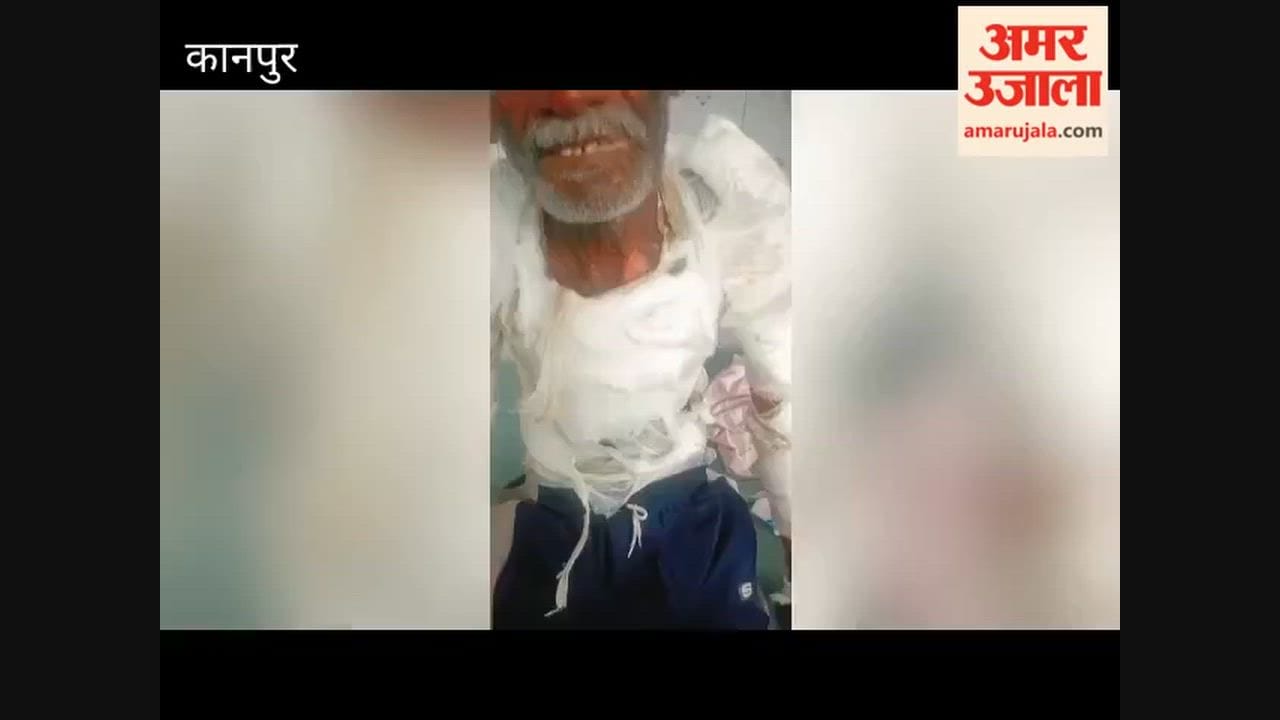 Kanpur: Daughter-in-law pours boiling hot water on father-in-law for refusing to transfer land in her name
