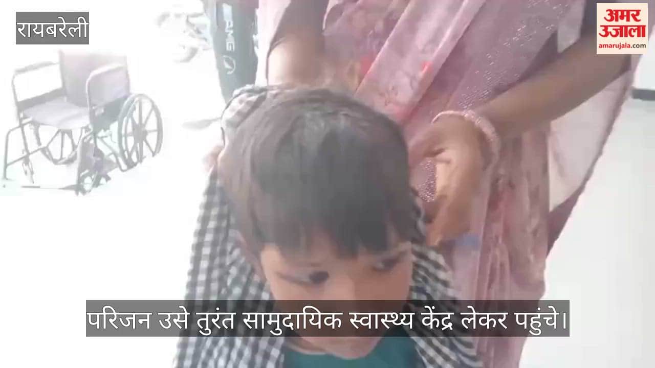 VIDEO: आंगन में सो रही मासूम कों बंदर ने काटा, गंभीर