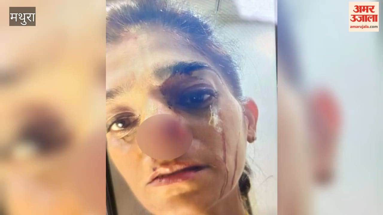 Young female devotee's nose bitten off in Govardhan; she was left bloodied.
