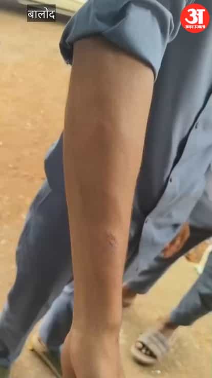 Balod: Teacher beats 5 students at Government ITI; FIR registered following uproar by families.
